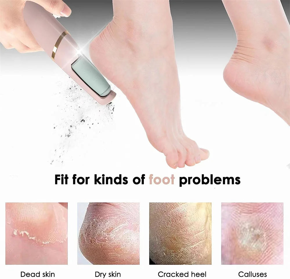 Electric Pedicure  Feet Exfoliator